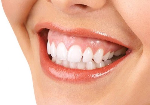 SonrisaGingival Sonrisa Gingival